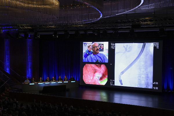Christie RGB лазерная проекция на 22-м Международном симпозиуме по эндоскопии – качественное изображение прямо из операционной