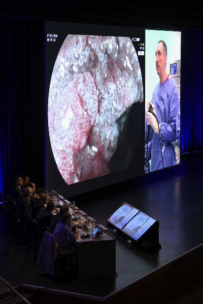 Christie RGB лазерная проекция на 22-м Международном симпозиуме по эндоскопии – качественное изображение прямо из операционной